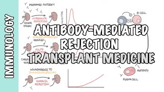 Transplant Medicine  Antibody mediated rejection [upl. by Gnuhn]