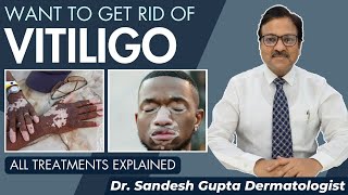 Vitiligo Truth Hope and Change fulllength [upl. by Assila]