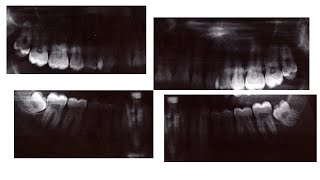 Imagerie Radiologique en Médecine Dentaire [upl. by Orms]