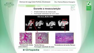 Doença de Legg Calvé Perthes Atualização Dra Patricia Moreno Grangeiro [upl. by Kyd]