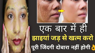 best face serum for glowing skin  face serum for clear and glowing skin कालापन झाइयां खत्म करें [upl. by Lacombe617]