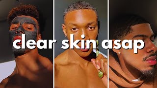 how to get clear skin for guys asap no bs guide [upl. by Koh]