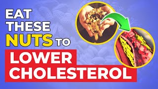 5 Best Nuts That Lower Cholesterol AND Blood Sugar [upl. by Atiuqcaj]