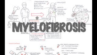 Primary Myelofibrosis  Overview presentation pathophysiology investigation treatment [upl. by Alesi]