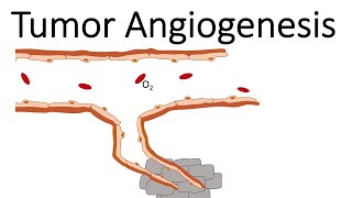 Tumor Angiogenesis [upl. by Maguire]