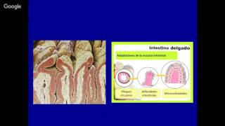 Galactosemia Fisiopatología diagnóstico y tratamiento [upl. by Wendi899]