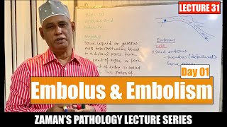 General Pathology Lecture 31  Embolus and Embolism  Day 1 [upl. by Nowed881]