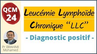 Leucèmie Lymphoide Chronique Diagnostic Positif  Hématologie QCM 24 [upl. by Ellenaej605]