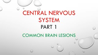 Common Brain Lesions CNS pathology [upl. by Nwahsir]