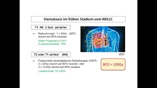 Stereotaktische Radiotherapie beim NSCLC im frühen Stadium  Strahlentherapie Prof Hilke Vorwerk [upl. by Tivad61]