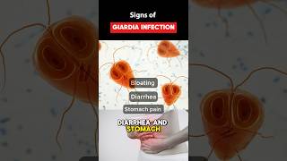 IBS Symptoms or Giardia Parasite Infection guthealth youtubeshorts shorts [upl. by Nananne]