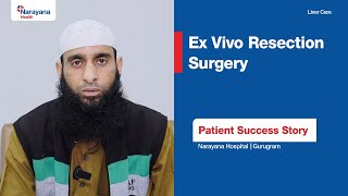 Success Story of Patient’s Ex Vivo Resection Surgery  Dr Sanjay Goja [upl. by Ecirtnom]