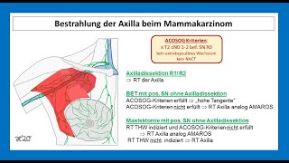 Bestrahlung vom axillären Lymphabflussgebiet beim MammaCa  Strahlentherapie Prof Hilke Vorwerk [upl. by Deryl273]