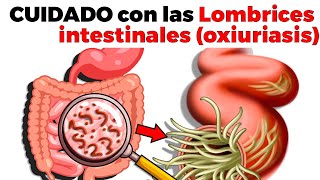 SÍNTOMAS DE LOMBRICES INTESTINALES oxiuriasis tratamiento y cómo prevenirlas [upl. by Saretta]