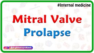 Mitral valve prolapse  Internal medicine lectures for FMGE and NEET PG by Dr Rajesh Gubba [upl. by Gellman]