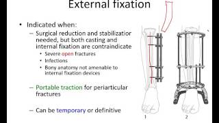 Orthopaedic trauma for med students 2 [upl. by Koloski]