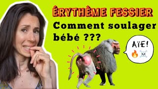 ÉRYTHÈME FESSIER Comment soigner les fesses rouges irritées de bébé  Solutions remèdes astuces [upl. by Norred48]