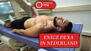 Ons VETPERCENTAGE  Gemeten Met Een DEXA SCAN Enige in Nederland [upl. by Nwad73]