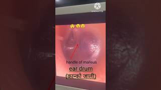 ear drum tympanic membrane कान्को जाली shorts eardrum ear 😳😳😳 [upl. by Sekyere]