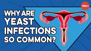 What causes yeast infections and how do you get rid of them  Liesbeth Demuyser [upl. by Ermengarde]