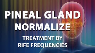 Pineal Gland Normalize  RIFE Frequencies Treatment  Energy amp Quantum Medicine with Bioresonance [upl. by Ilohcin]