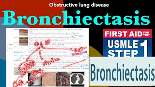 Obstructive lung disease Bronchiectasis in HindiUrdu by first aid for USMLE step 1 [upl. by Bram]