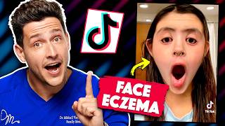 Shocking Medical Conditions On TikTok [upl. by Wenda413]