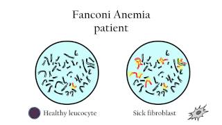 Fanconi Anemia  Genetic diagnosis [upl. by Roid]