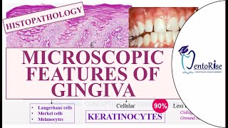 Microscopic features of gingiva  Histopathology of gingiva  Gingiva anatomy Periodontics Carranza [upl. by Olympias304]