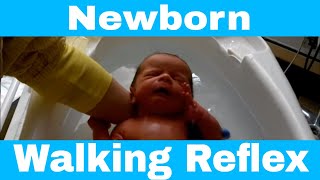 Primitive Reflex  Newborn Baby Walking Reflex Stepping Reflex [upl. by Loren142]