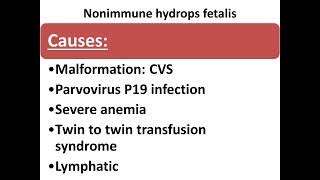 hydrops fetalis 2 [upl. by Tteve]