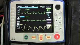 Instruction of the Zoll X Series  Part 3 Basic EKG Monitoring [upl. by Orpha]