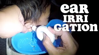 4 Year Old Boys Earwax Removed by EAR Irrigation using Bulb Syringe [upl. by Jenica710]