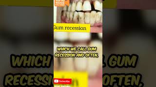 Solutions for all dental problems dentalcare dentaltips viral viralshorts yeeth care toothsi [upl. by Cummings]