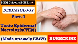 Toxic Epidermal Necrolysis made EASY UrduHindi mbbsguide mbbsguideandmedics [upl. by Sakovich]