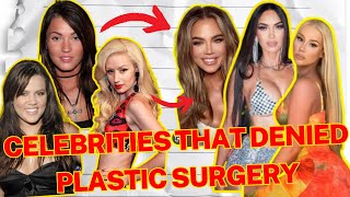 10 Celebs That Denied Plastic Surgery [upl. by Attenauq738]