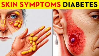 Your Skin Might Be Hiding These 15 Diabetes Symptoms [upl. by Yelkreb623]