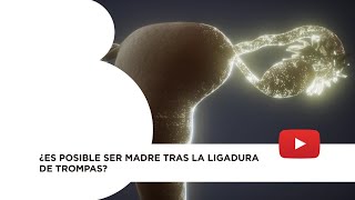 ¿Es posible quedar embarazada después de una ligadura de trompas l Dr Juan Luis [upl. by Akimahc]