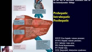 Pathophysiology of liver  part3 [upl. by Nolahp795]