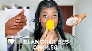 5 ASTUCES POUR BLANCHIR SES ONGLES [upl. by Enelhtac]