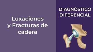 Diagnóstico Diferencial Luxaciones y Fracturas de cadera [upl. by Noerb550]