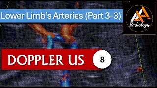 8  Lower Limbs Arteries Part 33 [upl. by Athene]