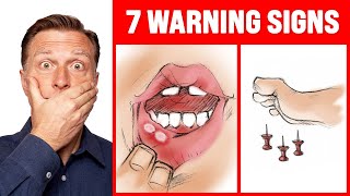 The 7 WARNING Signs of a B12 Deficiency  Dr Berg [upl. by Ainigriv444]