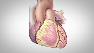 Coronary Artery Bypass Surgery [upl. by Pauline859]