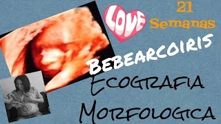 Ecografia morfologica del bebe 21 semanasmama [upl. by Terti]