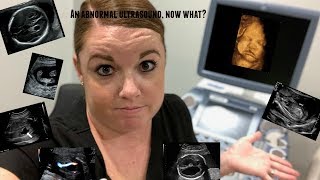 COMMON ABNORMAL ULTRASOUND FINDINGS NOW WHAT [upl. by Nozicka484]