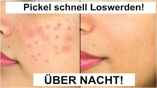 Pickel loswerden👍 Pickel entfernen statt abdecken  3 Tipps für starke Mädchen [upl. by Arym]