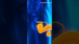 Testicular Torsion A MustKnow for Future Doctors medicalshorts SurgeryTips TesticularTorsion [upl. by Eeralav585]