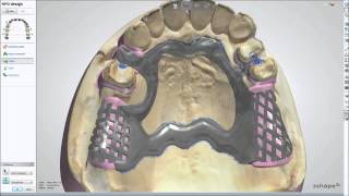 Modellguß im WIELAND 3shape DentalSystem 2013 [upl. by Hafler80]