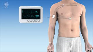 Hämodynamisches Monitoring Transfusion und Intensivmedizinische Basismaßnahmen [upl. by Atazroglam]